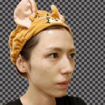 「すっぴんも可愛い」若槻千夏、シミ取りレーザーで“人生で1番のダウンタイム”SHOTに反響「包み隠さず見せてくれるとこ かっこいい」